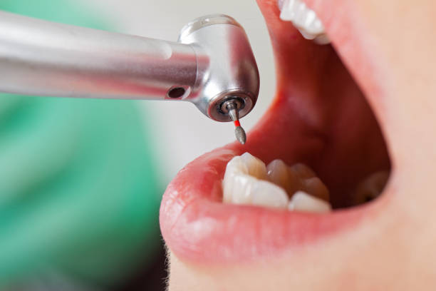 Best Pediatric Emergency Dentist in Shell Point, SC